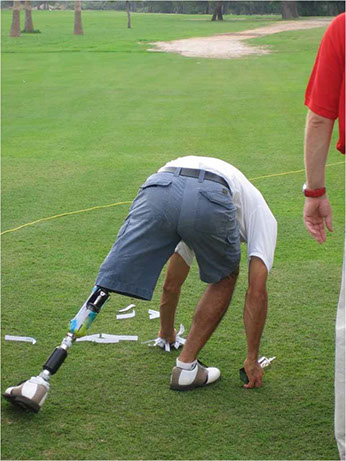 Jugador de golf amputado:Jugador de golf amputado de una pierna, con una prótesis ortopédica.&nbsp; 
